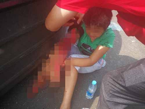 高速车祸现场一受伤女子跪地爬行,高速发生车祸幸存的6岁女孩后续