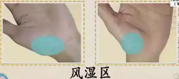 手上发紫中间发白,手上发紫发青还发痒是怎么回事