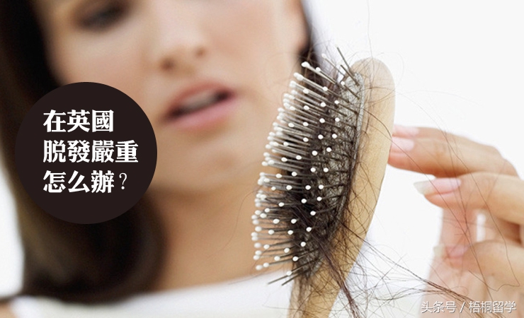 来英国后发际线高,在英国怎么保护发际线