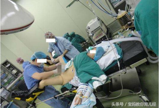 35岁女教师产下双胞胎,女老师顺产全麻