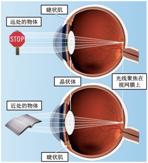 为什么配眼镜要散瞳验光,儿童散瞳验光配眼镜效果