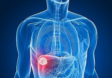 熬夜长胖如何减肥,熬夜长胖怎么减肥