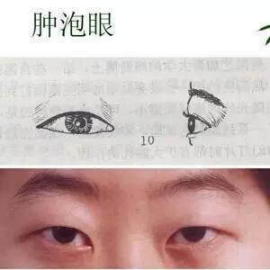 双眼皮原来这么简单自然无痕,做过的双眼皮如何看起来自然一些