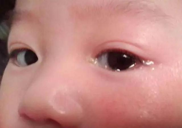 误食橡皮泥后会发生什么,误食橡皮泥对孩子的危害