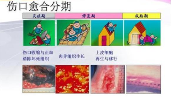术后忌口？别再被“发物”吓到了