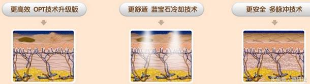 光电美肤美容项目,光电美肤效果怎么样