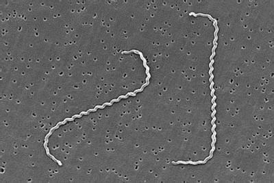 瀹犵墿鍠濅笉骞插噣鐨勬按鐢熺梾,瀹犵墿涔辨媺灞庡翱鎬庝箞瑙ｅ喅