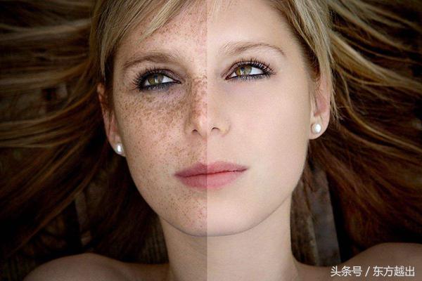 茶油祛斑最快最有效的方法,男士祛斑除黑色素最有效方法