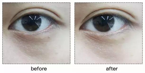 refacaratray瘦脸滚轮美容仪,refa进口滚轮瘦脸仪