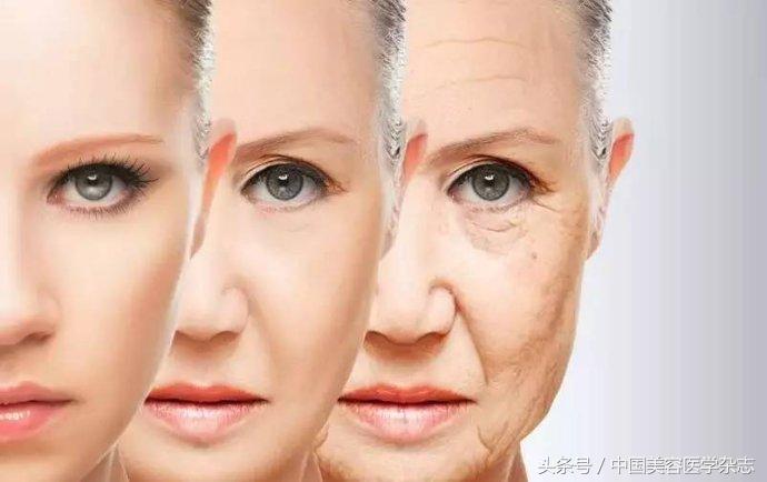 超声刀可以除皱吗,超声刀后面部凹陷还能恢复吗