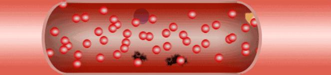 中医养生调理心室,心室养生秘法