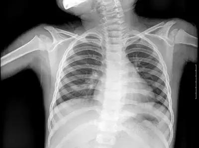 为啥医生让我做核磁，让他做CT？X光、CT、核磁到底有啥区别？