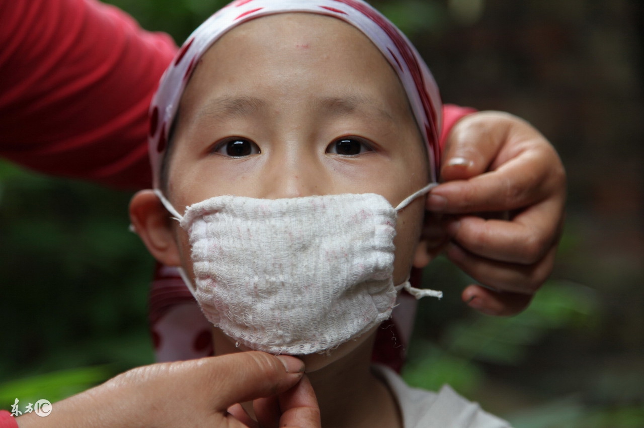 慢性白血病能活多久的视频,慢性白血病吃靶向药能活多久