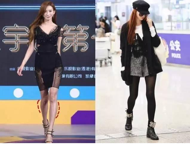 小腿外翻拉伸正确动作,小腿外翻能通过动作矫正吗