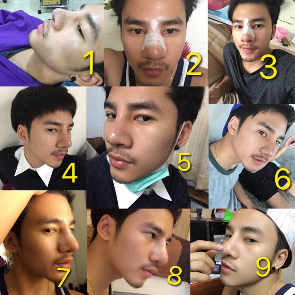 男人高鼻梁重要性,论有个高鼻梁的重要性