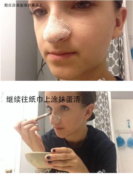 如何去黑头收缩毛孔最简单小方法,有效去黑头收缩毛孔的洗面奶