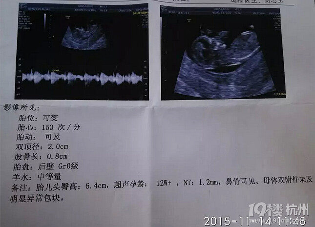 如愿生了个女宝,如愿备孕成功的记录