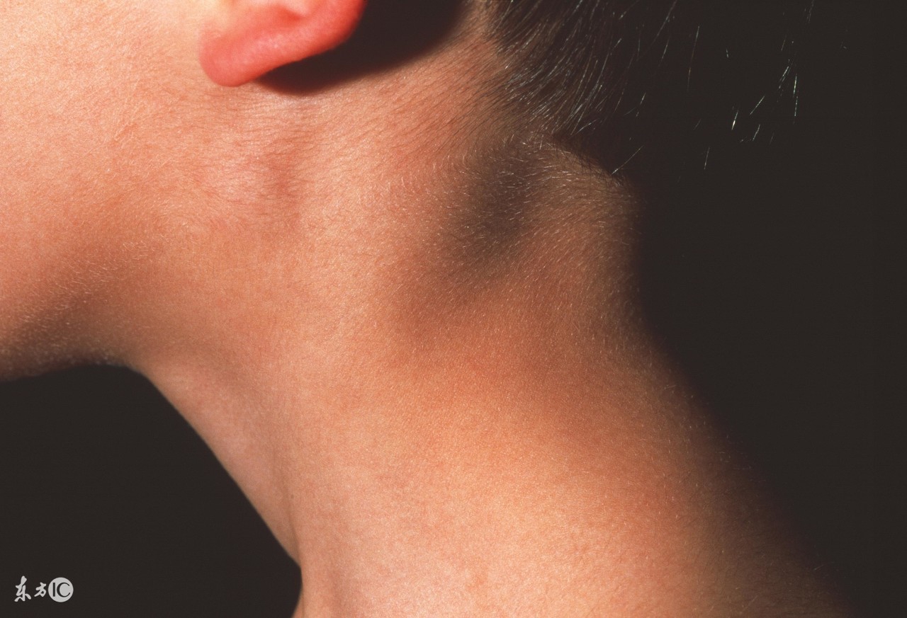 一个动作教你怎么自测身体健康,自己按摩淋巴的正确手法