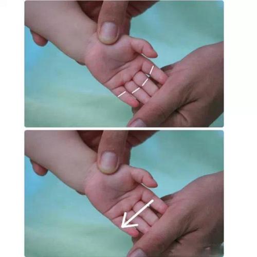 宝宝拉肚子快速有效的方法,宝宝拉肚子正确处理方法是