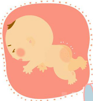 茶油婴儿变黑,茶油新生儿宝宝