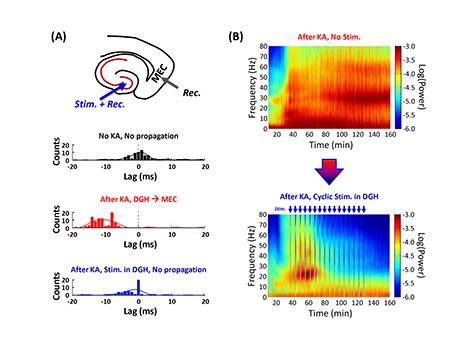深圳先进院精确解析癫痫波的“活动连接图谱”