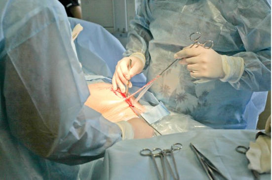 剖腹产横着开一刀还是竖着开一刀,剖腹产产房纪实