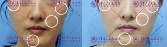 瓷娃娃美白过程,白瓷娃娃美白