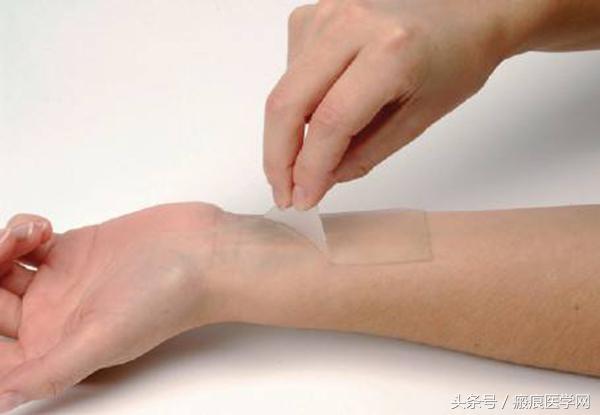 硅胶消除凹陷性疤痕,疤痕硅胶片的使用方法