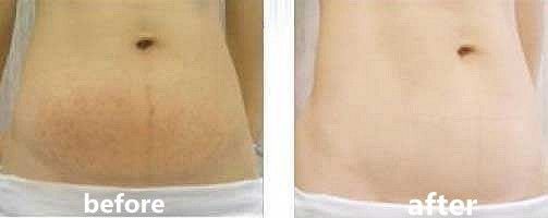 深扒热门贵妇面霜,深扒网红抗老成分真的这么有效吗