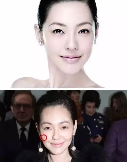 赵丽颖脸部痣,赵丽颖脸上美人痣
