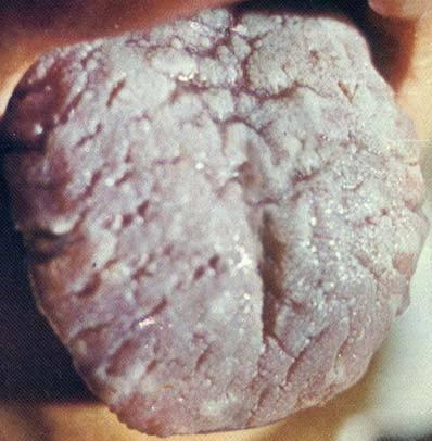 食物补钙补锌,精明妈妈补锌