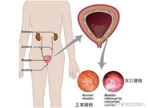 孕期用药一览表,孕期用药有讲求请遵循这4个原则