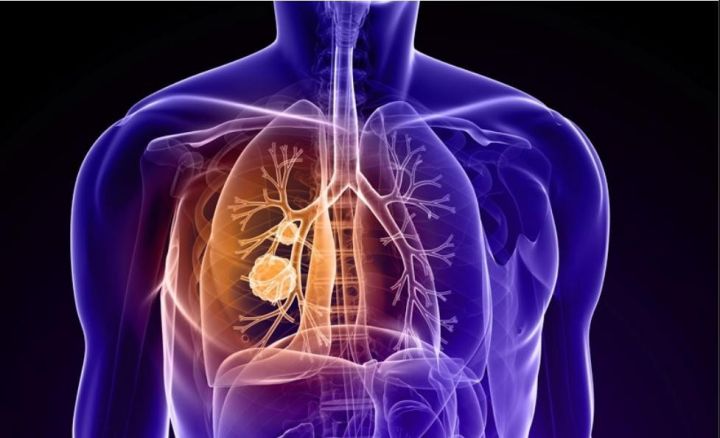 婴儿dha藻油会受日本影响吗,幼儿dha藻油种类