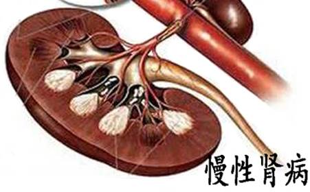 错失治疗肾病最佳时机，拖成肾衰竭！来自一个中年教师的悔恨！