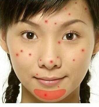 长痘真的影响颜值教你祛痘小妙招,祛痘小知识如何正确避免长痘