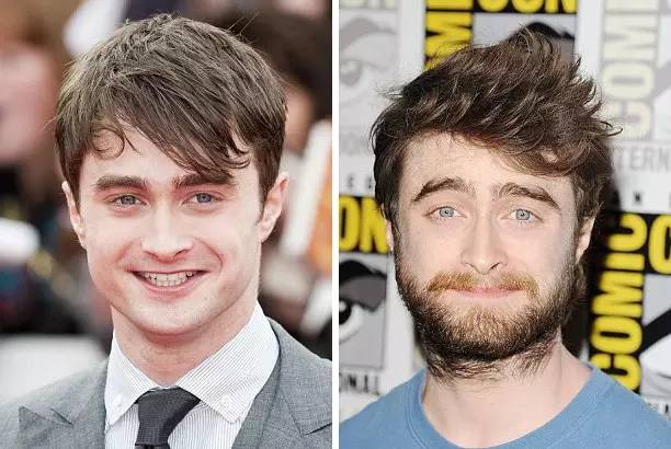 不帅气的胡须，不值得一留