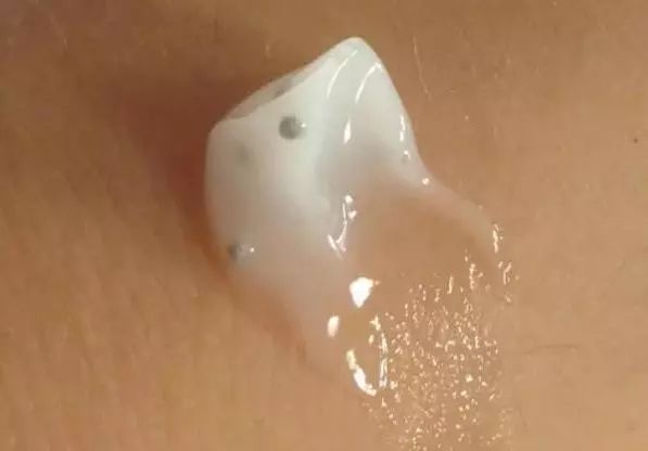 熬夜太多了皮肤变得有多差,一直熬夜皮肤很差怎么改善