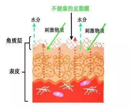 护肤品真的能解决问题性肌肤吗,护肤为什么要用大牌护肤品