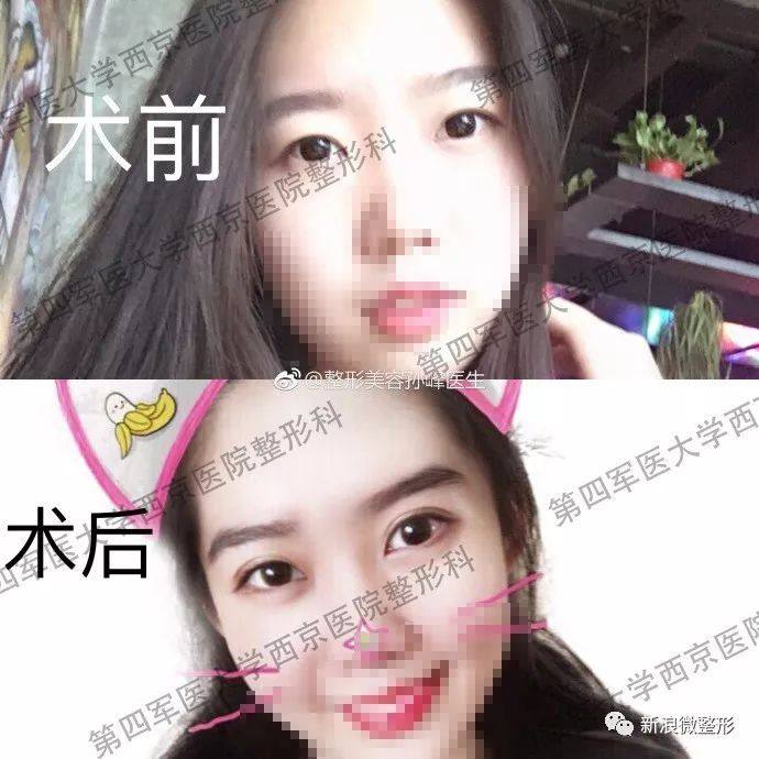 又到周四案例时间！快来看看这期有没有你想做的项目~