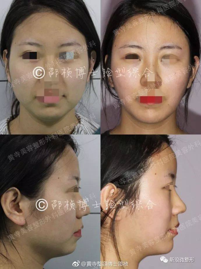 又到周四案例时间！快来看看这期有没有你想做的项目~