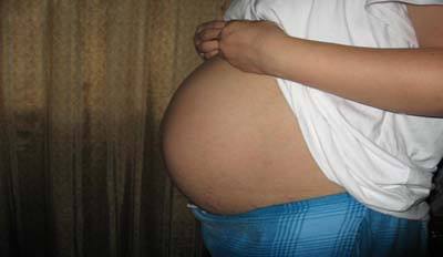 产道损伤是怎么回事？