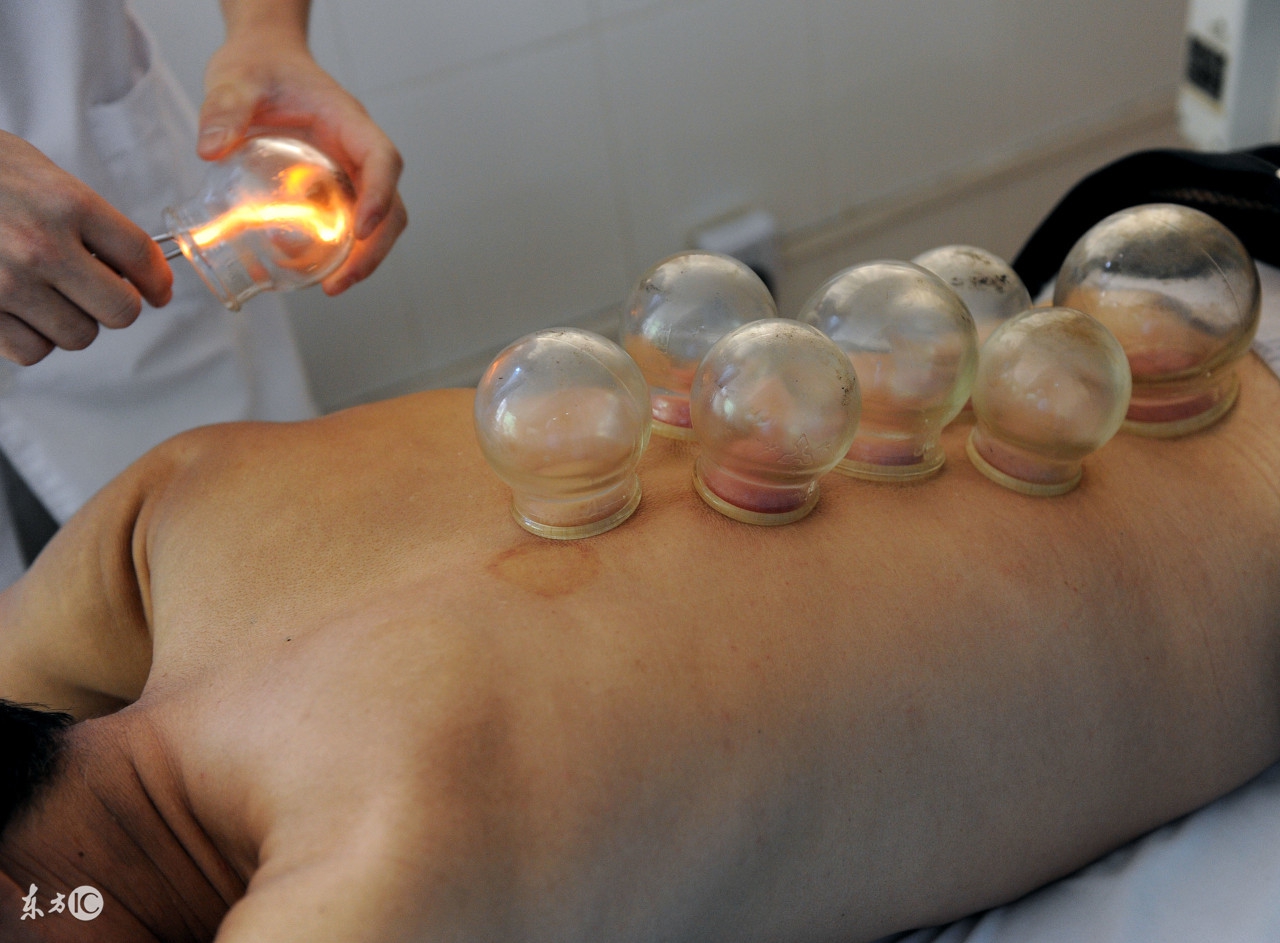 肺病能不能拔火罐,拔火罐十大禁忌穴位图