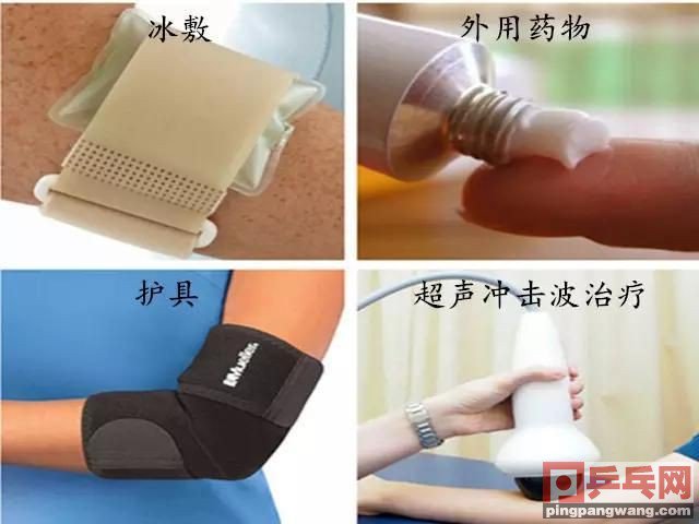 网球肘的治疗特效方法有吗,网球肘如何预防和治疗