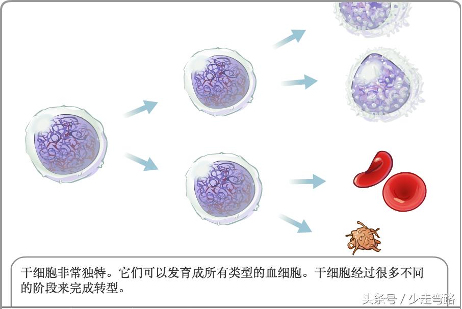 急性淋巴细胞白血病定义,小儿急性淋巴细胞性白血病
