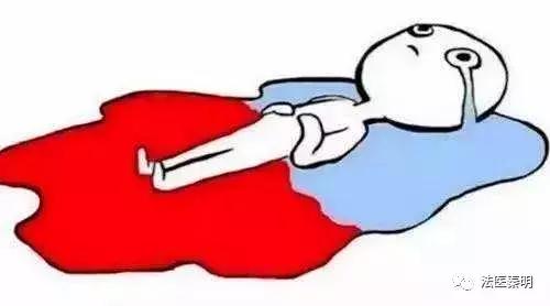 女人有两个子宫怎么办,有两个子宫怎么治疗