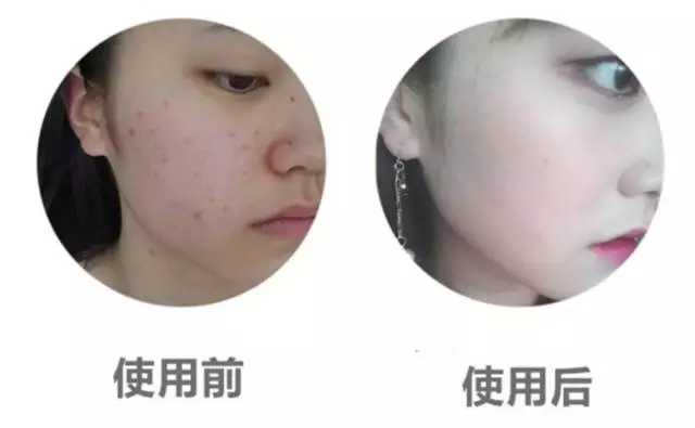 双11最畅销护肤品,双11拔草大牌化妆品