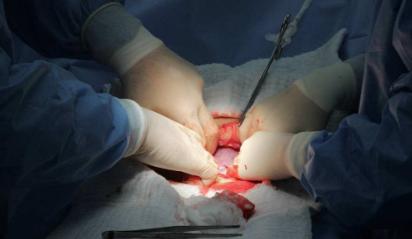 大头娃娃的顺产回忆