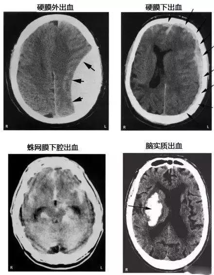 绘制神经系统的生理解剖图,人体骨骼血管神经系统解剖图
