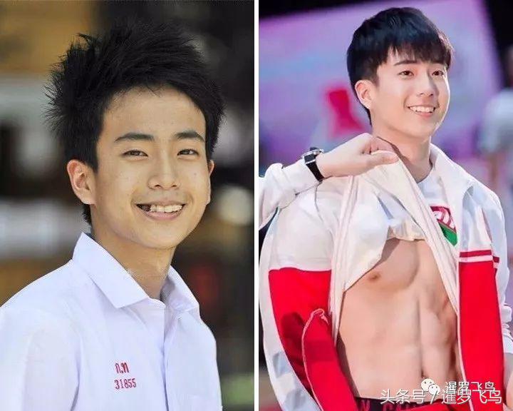 爱美戴牙套导致整排牙齿脱落！看着都疼！泰国医生发文警示