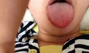 中医小儿舌诊辨证图谱,小儿舌诊辨证图谱课件